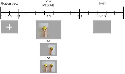 Effects of handedness on brain oscillatory activity during imagery and execution of upper limb movements